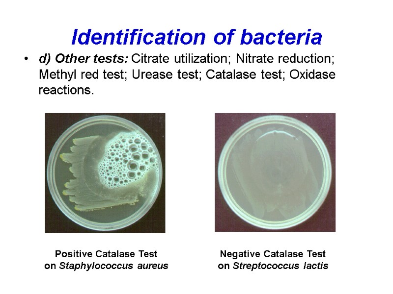 Identification of bacteria d) Other tests: Citrate utilization; Nitrate reduction; Methyl red test; Urease